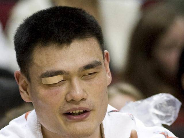 NBA眼珠子被打出来是谁?那些年赛场上的恐怖瞬间,真相其实没那么简单 NBA眼珠子被打出来是谁?那些年赛场上的恐怖瞬间,真相其实没那么简单